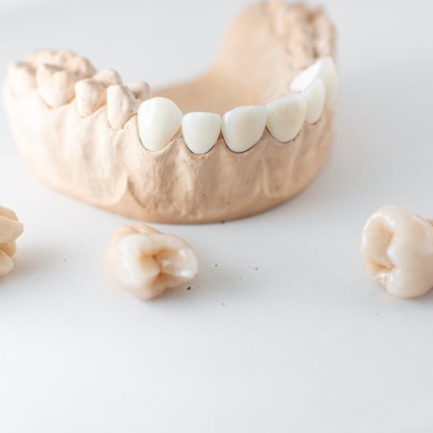 Model of artificial jaw with teeth