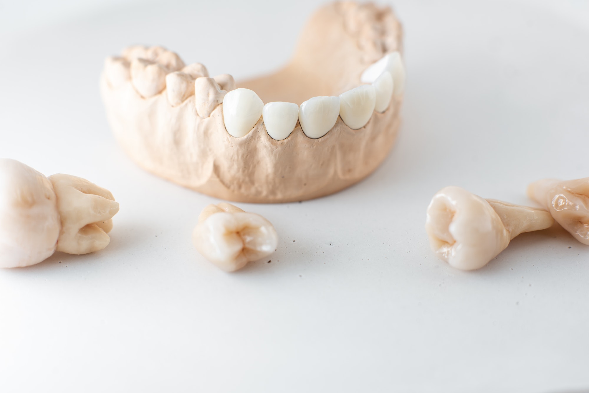 Model of artificial jaw with teeth