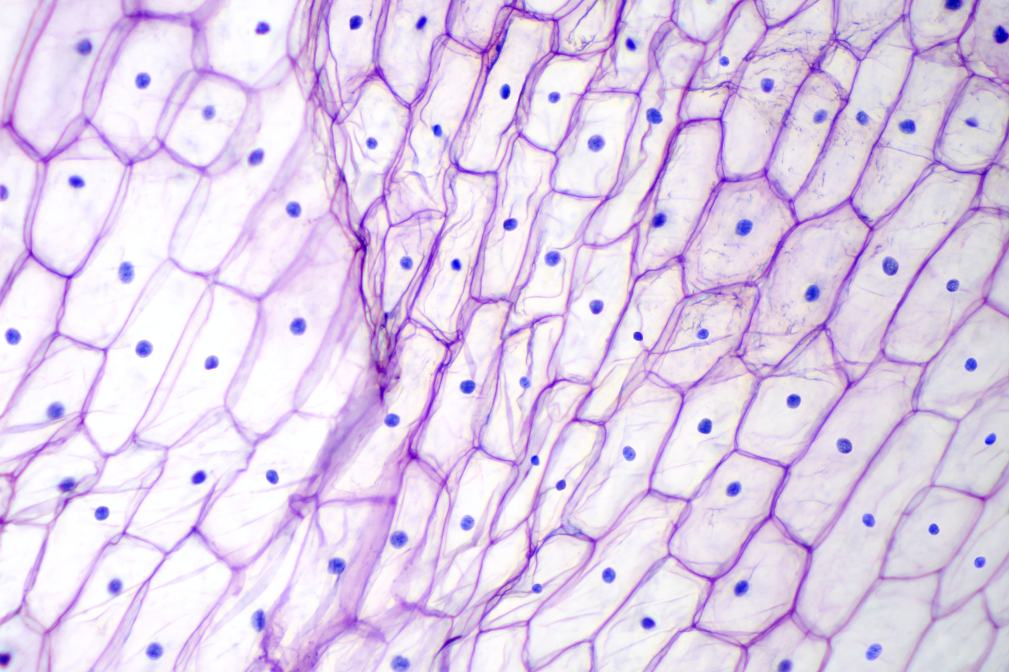 Onion epidermis with large cells under microscope